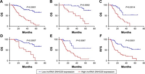 Figure 2 Kaplan–Meier curves showing the survival of glioma patients with different lncRNA SNHG20 expression levels.Notes: (A–E) OS curves stratified by lncRNA SNHG20 expression in total (A), low-grade (B), high-grade (C), small tumor size (D) and lager tumor size (E) glioma patients. (F–J) RFS curves stratified by lncRNA SNHG20 expression in total (F), low-grade (G), high-grade (H), small tumor size (I) and lager tumor size (J) glioma patients.Abbreviations: OS, overall survival; RFS, recurrence-free survival.