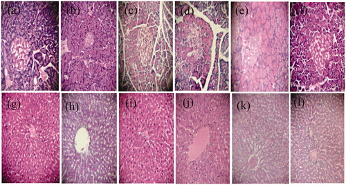 Figure 3. Effect of Spirulina platensis on the pancreas (a–f) and liver (g–l) of normal and diabetic rats H&E, 40×. Group 1 (a, g). Group 2 (b, h) Group 3 (c, i), Group 4 (d, j), Group 5 (e, k) and Group 6 (f, l).