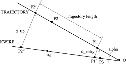 Figure 4. Determination of the trajectory translation at the entry point (d_entry) and tip (d_tip), and of the angle between the trajectory image and the k-wire fluoroscopic images (alpha).