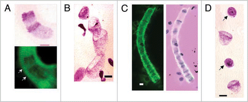 Figure 2 Bell shaped, metakaryotic nuclei in syncytia. (A) Feulgen purple stained stacking bell-to-bell symmetrical amitotic fission of bell shaped nuclei (upper) imposed over green Feulgen fluorescent image (lower) showing sarcomeric striations (arrowed) of syncytial walls (human fetal spinal cord, 9 wks). (B) Feulgen purple stained bell shaped nuclei in syncytium illustrating variety of nuclear dimensions (human fetal gut, 7 wks). (C) Green fluorescent image of a single syncytium with bell shaped nuclei (left image) and the same image merged with the image of Feulgen purple stained nuclei showing positions of the nuclei in syncytium (human fetal gut, 7 wks). Note, both “kissing cup” and “stacked cup” amitotic figures and bell shaped nucleus apparently emerging from end of syncytium. (D) Section of a Feulgen purple stained syncytium showing a portion of a larger series of eight condensed spherical nuclei (arrowed) between bell shaped nuclei interpreted as the result of synchronous asymmetrical amitoses (human fetal gut, 7 wks). Scale bar, 5 µm.