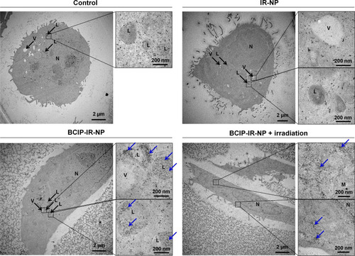 Figure 11 Ultra-thin section of the TEM images of the HaCaT keratinocytes treated with IR-NP and BCIP-IR-NP with and without 830-nm irradiation at 20 J/cm2 post-treatment. Possible dehydroindigo precipitates are indicated by blue arrows. The scale bars are displayed on each image.