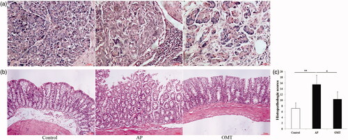 Figure 5. The inflammatory histologic changes of pancreas and intestine in control, AP and OMT groups, respectively. (a) Pancreatic histopathology in the in control, AP and OMT groups (100×). (b) Intestinal histopathology in the intestine of control, AP and OMT groups (100×). (c) Histopathologic scoring of intestinal injury was plotted in control, AP and OMT groups. Bars indicate ± S.E. *p < 0.05 compared with the control. **p < 0.01 compared with the control. Ctrl: saline treatment group; AP: Arg treatment group; OMT: Arg plus OMT treatment group.