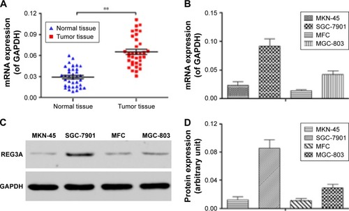 Figure 1 REG3A expression in GC tissues and cell lines.