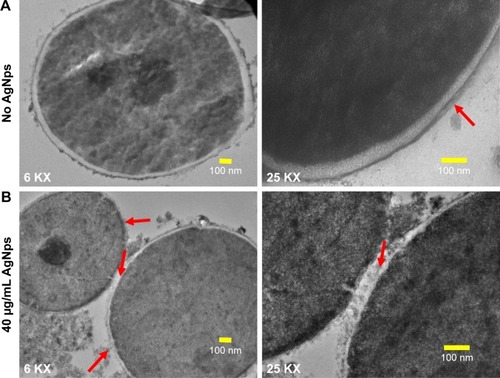 Figure 6 TEM images (at 6 KX and 25 KX) for Candida cells grown in the absence (no AgNps) and presence of AgNps. (A) Ultrastructure of cells grown without AgNps; cells without treatment revealed well-conserved ultrastructural features with a distinctive cell wall and cytoplasmic membrane and (B) cellular ultrastructure after treatment with 40 μg/mL (MIC90) AgNps; the red arrows indicate damage to the integrity of the cell wall and cytoplasmic membrane after treatment with AgNps.Abbreviations: AgNps, silver nanoparticles; KX, magnification; MIC, minimum inhibitory concentration; TEM, transmission electron microscopy.