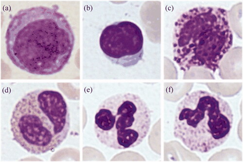Figure 1. White blood cells of undisclosed data set. (a) MON, (b) LYM, (c) BAS, (d) EOS, (e) SEG, (f) BAN.