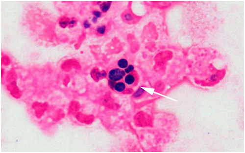 Figure 3 The white arrow shows that A. mycotoxinivorans were engulfed by leukocytes.