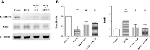 Figure 5 Vitamin D3-encapsulated nanoparticles inhibit the TGF-β1-induced epithelial-to-mesenchymal transition (EMT) of mesothelial cells (MCs) in vitro. (A) The Western blot analysis showed that 1α, 25(OH)2D3 (10−6 mol/L)-encapsulated nanoparticles had the same effect as the inhibited TGF-β1-induced EMT process of MCs. (B) Normalized data of protein levels of E-cadherin and Snail. (mean ± SD, n≥3; **P<0.01, ***P<0.001, compared with the control group; #P<0.05, ##P<0.01, compared with the TGF- β group).