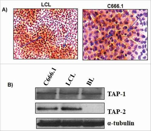 Figure 6. Viable cells from c666.1 and an LCL were analyzed through A) immunocytochemistry for the surface expression of HLA class I using the anti-W6/32 antibody, B) immunoblot analysis was done to analyze the expression of TAP1 and TAP2 in c666.1, BL cell line and LCL to assess the in-process integrity of transfected RNA. α-tubulin was taken as loading control.