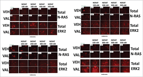 Figure 3. Neratinib and valproate down-regulate mutant N-RAS expression in PDX isolates of malignant melanoma. PDX isolates of N-RAS transformed melanoma cells were treated with vehicle control, neratinib (100 nM – 500 nM), sodium valproate (250 μM) or the drugs in combination for 6h. The cells were fixed in place and immunostaining performed to determine the expression and localization of N-RAS at 60X magnification (data from multiple separate images & treatments +/- SEM) *p < 0.05 less than vehicle control; **p < 0.05 less than value in neratinib treated cells.