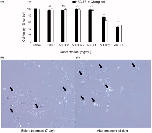 Figure 1. Effect of ASL on cell viabilities in HSC-T6/Chang liver cells and morphological changes in primary HSCs. (A) HSC-T6 and Chang liver cells were incubated with ASL at indicated concentrations for 24 h and the cell viability was determined by MTT assay. (B) Primary HSCs were cultured for 1 week and exposed to the ASL 0.1 mg/mL for 24 h. (C) Pictures were taken before and after 24 h treatment with ASL. Magnification was 100×. Arrows indicate HSCs. The data are expressed as means ± SEM (n = 10), using one-way ANOVA followed by Student’s t-test. NS: Not significant; **p < 0.01 and ***p < 0.001 compared with control group.