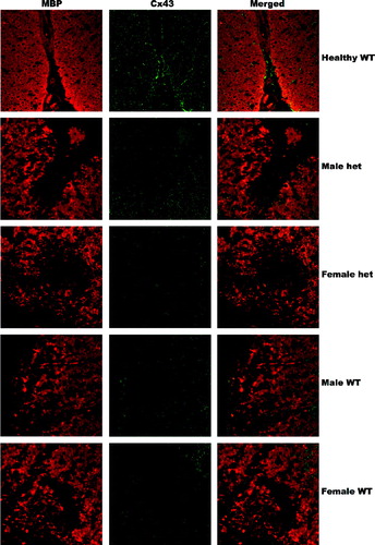 Figure 4 Cx43 expression is decreased in all lesions regardless of genotype or sex. All lesions, determined by the decreased myelin (red) are devoid of Cx43 (green) regardless of sex or genotype compared to healthy WT controls. Images are at 630X magnification.