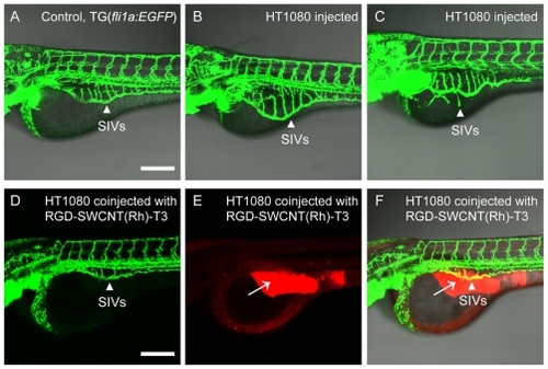 Figure 8 Blood vessels of transgenic fli1a:EGFP zebrafish embryos can be easily observed under the confocal microscope (A), and SIVs are marked by white arrows. Angiogenic responses (B and C) are triggered by tumor cell xenografts and targeted antiangiogenic therapy of RGD-SWCNT(Rh)-thalidomide (D, E and F) in transgenic fli1a:EGFP zebrafish embryos. Engraftment of human HT1080 fibrosarcoma cells, which secrete vascular endothelial growth factors, triggers ectopic angiogenesis of SIVs (B and C). Note morphological features of angiogenic response with engraftment of human HT1080 fibrosarcoma cells. When coinjected with RGD-SWCNT(Rh)-thalidomide (E), ectopic growth of angiogenesis of the SIV is obviously inhibited (D and F) in treated zebrafish embryos. White arrows (E and F) indicate presence of RGD-SWCNT(Rh)-thalidomide after injection. (F) is the merge of (D) and (E). Scale bar: 200 μm.Abbreviations: RGD, cyclic arginine-glycine-aspartic peptide; SWCNT, single-walled carbon nanotubes; Rh, rhodamine; EGFP, enhanced green fluorescent protein; SIVs, subintestinal vessels.