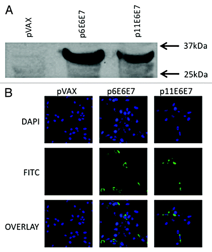 Figure 2. In vivo expression of p6E6E7 and p11E6E7. Gene products were isolated from lysed transfected 293-T cells, run through SDS-PAGE gel, and detected using autoradiography. Both HPV 6 and HPV 11 E6/E7 proteins are approximately 32kDa each (A). Human rhabdomyosarcoma (RD) cells were also transfected with p6E6E7 and p11E6E7 and later fixed after immunofluorescence staining. FITC fluorescence confirms expression of p6E6E7 and p11E6E7 (B). DAPI fluorescence confirms nuclei localization consequent of Hoechst staining.