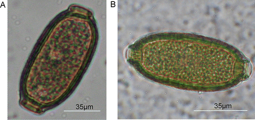 Figure 1  Capillaria spp. eggs from two different New Zealand passerines. A, Capillaria sp. egg of a tui. B, Capillaria sp. egg from a hihi from Mt. Bruce NWC.