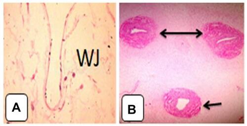 Figure 1 Cross-section of the mature umbilical cord and schematic representation of mature umbilical cord showing (A) wharton’s jelly with artery, (B) one umbilical vein (single headed arrow), and two arteries (double headed arrow) with Wharton’s jelly H&E. 4x.