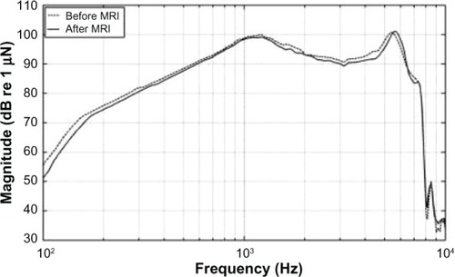 Figure 8 The maximum power output from the implant before (dashed line) and after MRI (solid line) acoustically measured at 90 dB SPL.