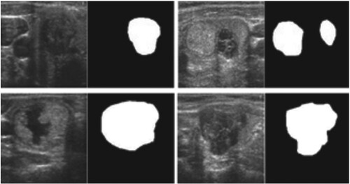 Figure 10. Thyroid sample images for the TDID data set.