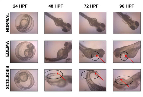 Figure 11 Microscope images showing incidence of malformations in zebrafish embryo, including PE and SC, as indicated by a black circle and arrow.