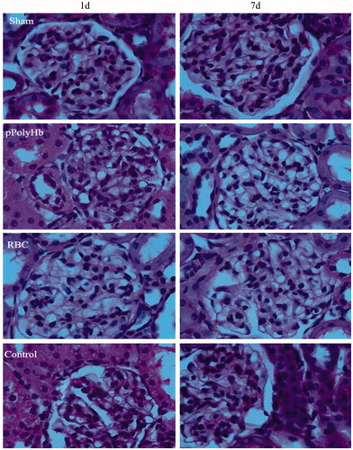 Figure 3. Microscopic observations of kidney sections from rats that underwent isovolemic hemodilution and infusion with pPolyHb or RBC. The left column shows specimens taken 1 d after the procedure, and the right column shows specimens taken 7 d after the procedure (1000 × magnification).