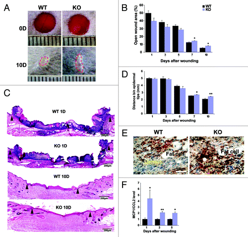 Figure 1. Wound healing is delayed in Nesprin-2 Giant knock out mice and the macrophage population is increased in KO mice. (A) Wounds from WT and Nesprin-2 KO mice at day (D) 0 and 10. The dotted red line indicates the wound area left open at day 10 (10D). (B) Graph showing progress in wound closure in WT and Nesprin-2 KO mice. At each time point wounds from WT and KO mice (n = 2 wounds/mouse; six mice per time point) were analyzed and the percentage (%) of the open wound area was calculated from macroscopic observation (*p < 0.05). (C) Skin sections of WT and KO were stained with HE (shown for day 1 and 10). The position of the migrating epithelial tip is indicated by arrowheads. (D) Distance between the migrating epidermal tips during wound healing. At day 7 and 10 the distance differs significantly in WT and KO (n = 3–6 sections/wound/mouse, *p < 0.05 and **p < 0.01). (E) Detection of macrophages with F4/80 antibody. Brown staining indicates F4/80 stained cells (shown for day 5). (F) Quantitative PCR analysis shows significant upregulation of chemokine MCP1/CCL2 in KO skin compared with WT at all three time points (n = 6, *p < 0.05 and **p < 0.01; fold changes are given in arbitrary units).