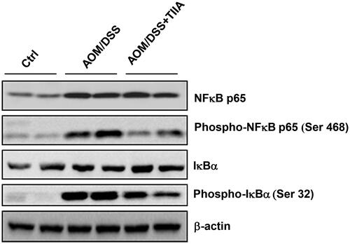 Figure 5. Tanshinone IIA downruglated the NF-κB signalling pathway. AOM/DSS treatment promoted the phosphorylation of p65-NF-κB and IκBα in colonic tissues of the mice, whereas administration of tanshinone IIA significantly inhibited activation of the NF-κB signalling pathway. β-Actin was used as a loading control. Data are representative of at least three experiments.