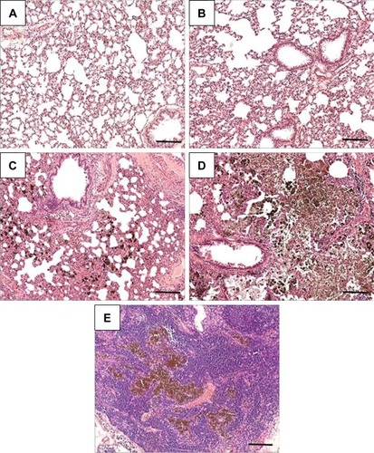Figure 5 H&E-stained sections of lung (A–D) and hilar lymph-node (E) tissue from animals in groups C (A), VT (B), LD (C), and HD (D, E).Notes: (C, D) Macrophages laden with TiO2 NPs and thickened (edematous) interstitial mass; (E) large mass of NP-laden macrophages in the lymph node. Bar 200 µm.Abbreviations: C, control; HD, high dose (18 mg/kg body weight); LD, low dose (5 mg/kg body weight); NP, nanoparticle; VT, vehicle-treated.
