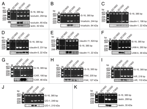 Figure 2. Expression of BTB constituent genes by Sertoli and germ cells, and the testis. Germ cells (GC, n = 3) were isolated from 90-d-old rat testes and immediately harvested in either TRIzol® reagent or lysis buffer. Sertoli cells (SC, n = 2) were isolated from 20-d-old rat testes, seeded onto Matrigel™-coated 12-well plates at 0.5 × 106 cells/cm2, hypotonically treated and cultured for 4 d before being harvested as described above. Testes (T, n = 2) were obtained from 90-d-old rats and used either for RNA extraction or lysate preparation. RT-PCR and immunoblotting were used to determine whether occludin (A), tricellulin (B), claudin-1 (C), claudin-5 (D), claudin-11 (E), JAM-A (F), CAR (G), FAK (H), AR (I), ZO-1 (J), and testin (K) were expressed by Sertoli and germ cells, and the testis. S-16 was used as a control in PCR experiments. Tables 1 and 2 list the primers and antibodies, respectively, that were used for this experiment. M, marker; bp, base pair; IB, immunoblotting.