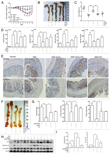 Figure 9. Andrographolide-driven mitophagy-mediated NLRP3 inflammasome inactivation is responsible for amelioration of murine models for colitis and CAC. (A–E) Mice were treated with 2.5% DSS in their drinking water for 7 d to induce colitis. Andro (5 mg/kg) was administered i.p. daily. CQ (50 mg/kg) was administered i.p. every 2 d. Mice were sacrificed on d 10 after colitis induction. Values are mean ± SEM of 6 mice/group. (A) The body weight of the mice was measured and presented as a percentage of the original body weight. (B) The colon was photographed. (C) The length of the colon was measured when the mice were sacrificed. (D) Protein levels of various cytokines in colon homogenates from DSS-induced mice at d 10 were examined by ELISA. *P < 0.05, **P < 0.01. (E) Expression of PTGS2/COX2 and p-RELA/p-p65 were examined by immunohistochemical staining of paraffin-embedded colon sections from DSS-induced mice at d 10. (F–I) Mice were injected i.p. with a single dose (7.5 mg/kg) of AOM followed by 3 cycles of 2.5% DSS given in the drinking water for 5 d. Andro (15 mg/kg) was given i.g. daily and CQ (50 mg/kg) was i.p. administered every 2 d during the interval between DSS cycles. Mice were sacrificed on d 95 after CAC induction. Values are mean ± SEM of 6 mice/group. (F) The inside of the colon was photographed. (G) Tumor numbers, size, and load were measured. *P < 0.05, **P < 0.01. (H) Macrophages were isolated from the spleen of AOM-DSS mice on d 95 using commercial magnetic beads as described in Materials and Methods. After stimulation with 5 mM ATP for 30 min, proteins were collected for western blotting. (I) Statistical data of the expressions of CASP1 and LC3 from 6 mice were shown. *P < 0.05. Andro, andrographolide.