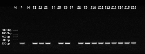 Figure 8. The electrophoresis results of PCR products using IMP primers. M: DL2000 Marker, P: Positive control, N: Negative control, S1-S16: Experimental strains.