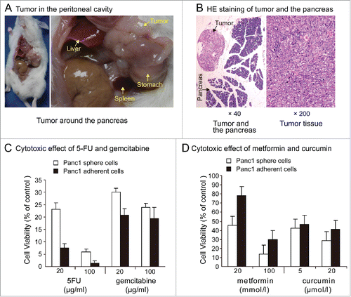 Figure 4. (A). Tumor in peritoneal cavity. Eight weeks after the intraperitoneal injection of 1000,000 individual Panc1 sphere cells, tumor nodules around the pancreas appeared in one of the 6 NOD/SCID mice. (B). HE staining of tumor and the pancreas. (C). Chemoresistance. Exposure to 5-FU (20,100 μg / ml) or gemcitabine (20,100μg / ml) for 5 days, cell viability was significantly higher in Panc1 sphere cells than in adherent cells. (D). Cytotoxic effects of metformin and curcumin. Cell growth of Panc1 adherent cells and sphere cells can all be inhibited by metformin and curcumin. Exposure to metformin（20, 100 mmol/l）or curcumin（5, 20μmol/l）for 5 days, cell viability was significantly lower in Panc1 sphere cells than in adherent cells.