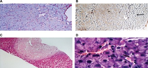 Figure 2 Histologic features of the liver parenchyma in INCPH.