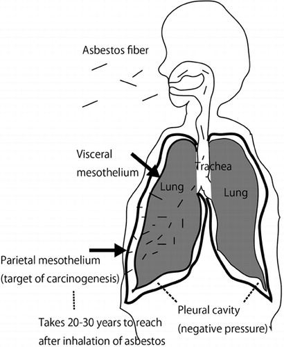 Figure 1. Mechanism of asbestos-induced mesothelial carcinogenesis.