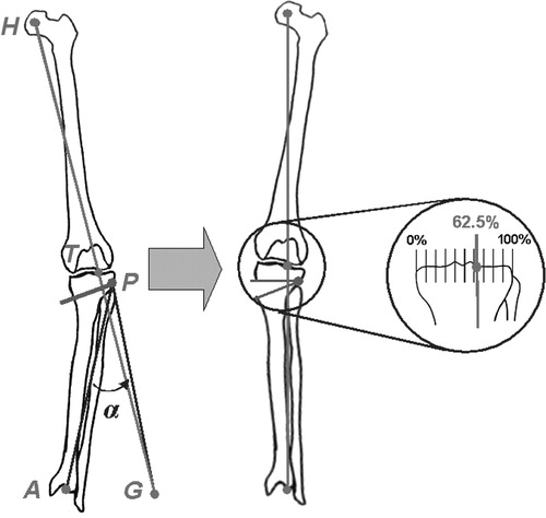 Figure 4. For the correction of frontal plane deformity, wedge size is determined according to the target position of the weight-bearing axis, where H is the hip center, A the ankle center, T the target position of the weight-bearing axis, P the position of the hinge axis, G the anticipated postoperative position of the ankle center, and α the wedge size Citation[14].