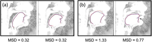 Figure 2. (color online) Examples of the tongue contour prediction in comparison with the manual delineation for speaker S1. Image brightness is changed for better visibility. Predicted contours are denoted by the lighter (red) curves, manually delineated contours are denoted by the darker (blue) curves. (a) Best examples. (b) Typical errors: hard palate is captured – left image, the bend in the region of the front genioglossus muscles is excluded (denoted by the arrow) – the right image