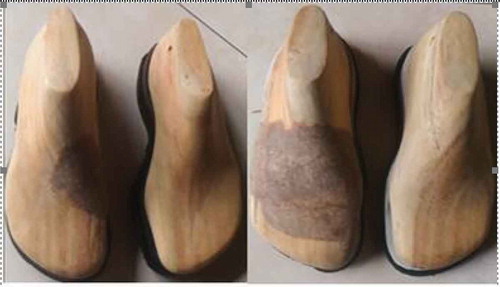 Figure 10. Shoe lasts of shoes manufactured for two patients.