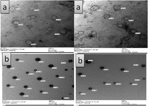 Figure 3. Transmission electron microscopy (TEM) photographs of: (a) MAP- loaded ethosomes (FE7), (b) MAP- loaded niosomes (FN3).