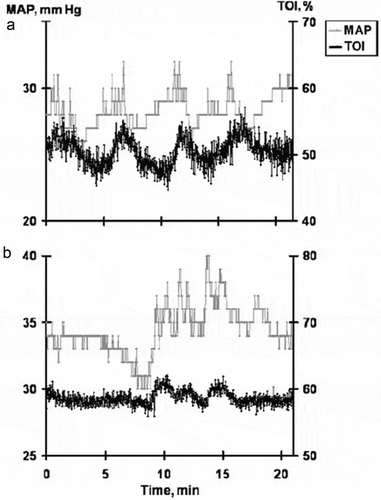 Figure 3. Example of high TFA for TOI and MAP values in the ultralow frequency from the Wong et al. study in 2 preterm born infants born at 23 and 25 weeks gestation, shown respectively in (a) and (b) [Citation34]. The infant in (a) showed fluctuations of TOI of higher magnitude in response to changes in MAP, compared with the infant in (b). Accordingly, the value of gain in the ULF range for the recording in (a) was higher than the value for the recording in (b) (0.8 vs 0.4%/mm Hg, respectively). Note that both recordings showed concordant changes between MAP and TOI waveforms, with the ULF coherence values both at 0.6. Reproduced with permission from Pediatrics, Vol. 121, Page(s) e604-11, Copyright © 2008 by the AAP. Abbreviations: TOI; tissue oxygenation index, MAP; mean arterial pressure, ULG; ultra-low frequency.