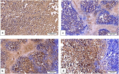 Figure 15. Sections of Ehrlich solid tumour tissue immunohistochemically labelled for VEGF (×200). (a) The untreated control demonstrates high VEGF immunoreactivity. (b) DOX immunoreactivity for VEGF was moderate. (c) 8b revealed no appreciable VEGF immunoreactivity. (d) 3b indicated moderate VEGF positivity in the epidermal growth factor receptor.