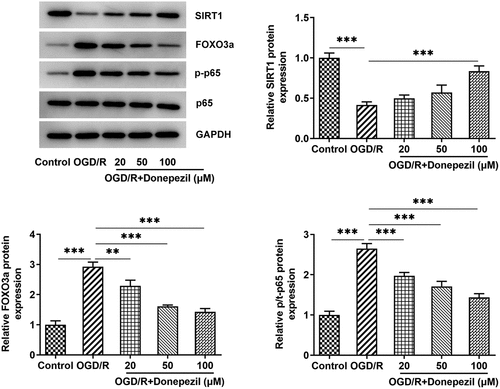 Figure 4. Donepezil regulates the SIRT1/FOXO3a/NF-κB signaling pathways. The expressions of SIRT1, FOXO3a, p-p65 and p65 were detected by the use of Western blot in OGD/R-induced HBMECs treated with donepezil (20, 50, 100 μM). Results are the mean ± SD. **P < 0.01, ***P < 0.001.
