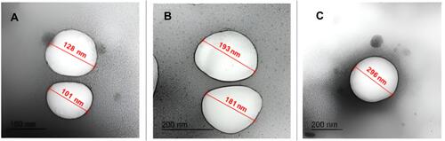 Figure 4 Transmission electron micrographs of placebo PLGA NSs showing unloaded centered core. (A–C) for P2, P5, and P8 respectively. Image J software utilized for measurements display.