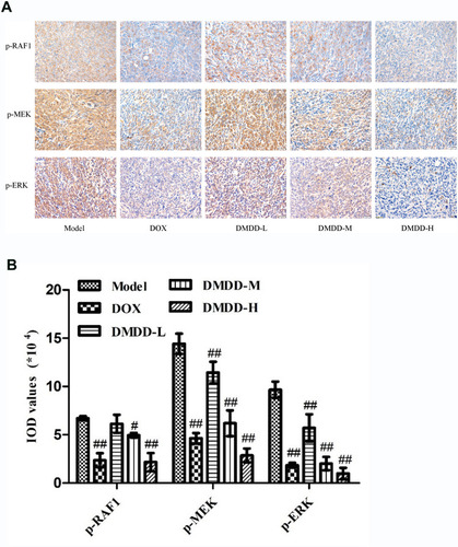 Figure 13 Immunohistochemical results of breast cancer tumor tissue.