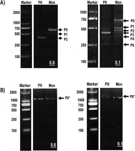 Figure 4. Electrophoresis analysis of PCR products from platelet and monocyte cDNA encompassing exons 1–5 and 5–15. Platelet (Plt) and Monocyte (Mon) cDNA was amplified using PCR (see Materials and Methods) and analyzed with 2% gel electrophoresis using a molecular weight standard as a marker. (A): electrophoresis analysis of exons 1–5, normal transcript (P0), and alternative splice products (P1–P5) are shown; (B) electrophoresis analysis of exons 5–15; the figure shows only one normal band (P0*) in both Plts and Mons.