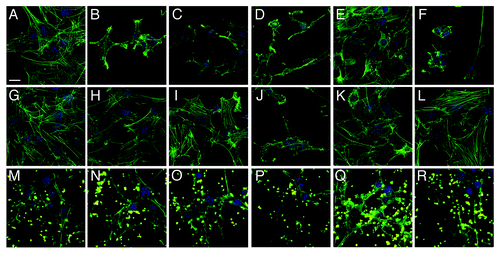 Figure 5. Visualization of anti-adhesion treatment of 3T3 cells for representative examples from each group of bacterial isolate. 3T3 cells were either left untreated (top row), pre-incubated with BL21-MAM7 (middle row) or pre-treated with bead-immobilized MAM7 (bottom row). Cells were then left uninfected (controls) (A, G and M) or infected with ABC isolate #1 (B, H and N), P. aeruginosa isolate #1 (C, I and O), P. aeruginosa isolate #3 (D, J and P), K. pneumoniae isolate #1 (E, K and Q) or E. coli isolate #5 (F, L and R) for 4 h. Cells were stained for actin (phalloidin-Alexa488, green) and DNA (Hoechst stain). Fluorescent latex beads are shown in yellow. Scalebar, 20 μm.