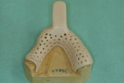 Figure 7 Spaced and perforated mandibular custom tray.