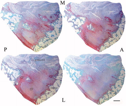 Figure 1. Serial transverse sections show several tissues appearing simultaneously in each section. Note the fibrocartilage appearing red and ligament appearing green (A, anterior; P, posterior; M, medial; L, lateral). Scale bar = 1 mm. Safranin O/fast green staining.