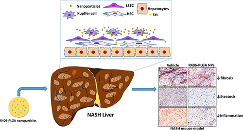 Figure 7 PLGA nanoparticle-based delivery of SYK pathway inhibitors for NASH treatment. This study utilized R406, a small molecule inhibitor, and synthesized PLGA nanoparticles to block the Fc receptor signaling pathway, specifically inhibiting the SYK pathway and reducing immune complex-mediated inflammation. Reprinted from Kurniawan DW, Jajoriya AK, Dhawan G et al. Therapeutic inhibition of spleen tyrosine kinase in inflammatory macrophages using PLGA nanoparticles for the treatment of non-alcoholic steatohepatitis. J Control Release. 2018; 288: 227–238. Creative Commons.Citation180