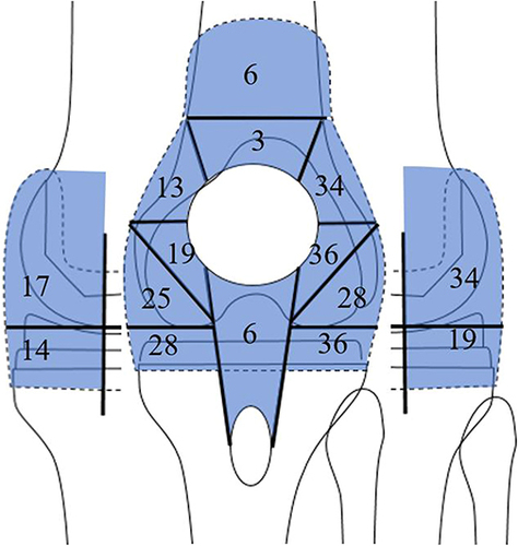 Figure 4 Synovitis mapping. The percentage of synovitis is shown.