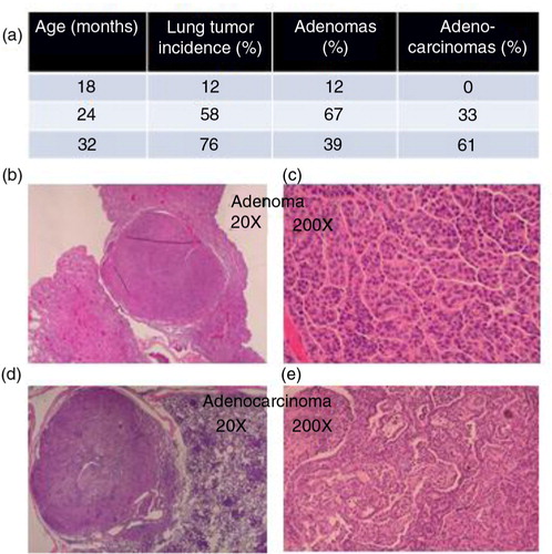 Fig. 1 (a) Lung adenomas progress to adenocarcinomas in male CB6F1 mice (N=18–22) in an age-dependent manner. Adenomas are characterized by a well-encapsulated clump (b) of moderately disorganized epithelial cells with features resembling normal formational architecture (c). Adenocarcinomas are characterized by invasive capsular penetration (d) and a highly disorganized cellular configuration with extensive mitotic activity (e).