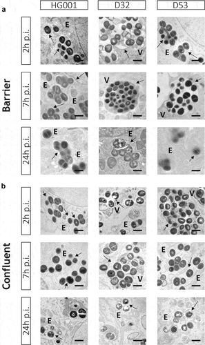Figure 3. Bacteria internalized by endothelial cells remain localized within membrane-enclosed compartments. Transmission electron microscopy images of HUVEC infected with the S. aureus strains HG001, D32 or D53 in the barrier (a) and confluent (b) conditions. In both conditions, the investigated S. aureus strains show replication from 2 h to 7 h p.i. Electron-dense (e) compartments of different sizes and vacuole-like structures (v) are indicated in the different panels. No cytoplasmic bacteria were detectable in both conditions. Arrows indicate replicating bacteria. Scale bar : 1 µm. For additional images, see Supplemental Figure S3