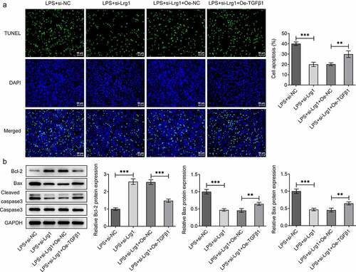 Figure 6. Lrg1 silencing attenuates LPS-induced apoptosis of HT22 cells through inhibition of TGFβ1/SMAD signaling pathway. (A) TUNEL assay was to detect cell apoptosis. (Magnification, x200). (B) Western blot was to analyze the protein levels of apoptosis-related factors. **P<0.01, ***P<0.001.